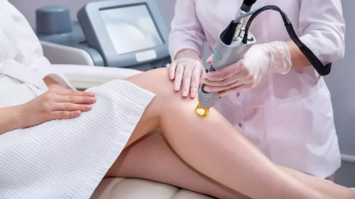 Epilation laser